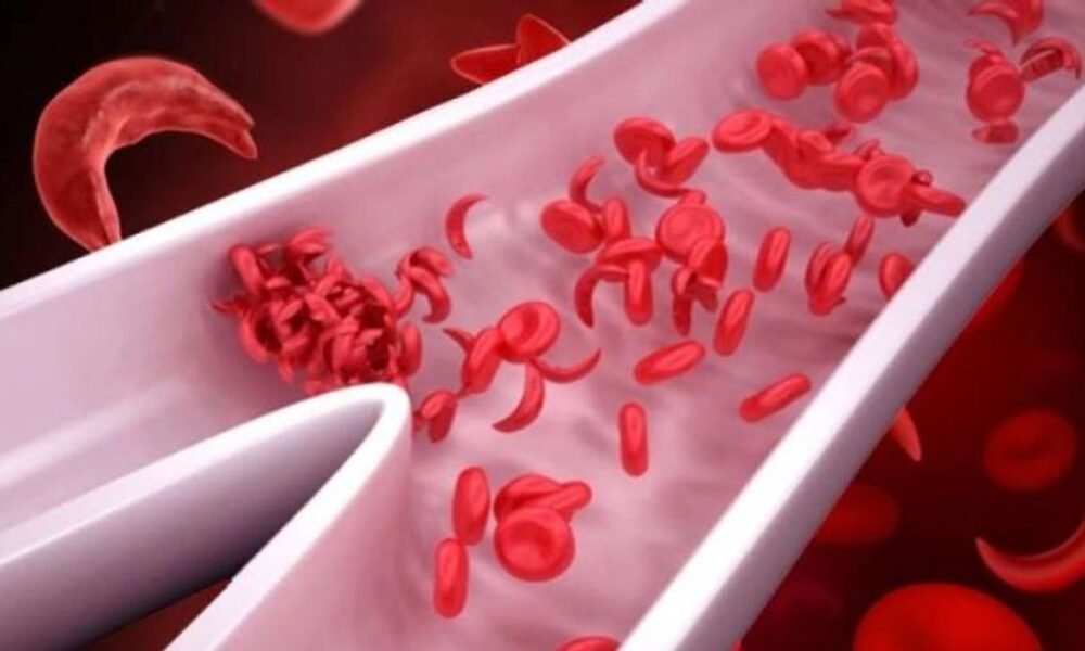 blood loss vijayaprabha