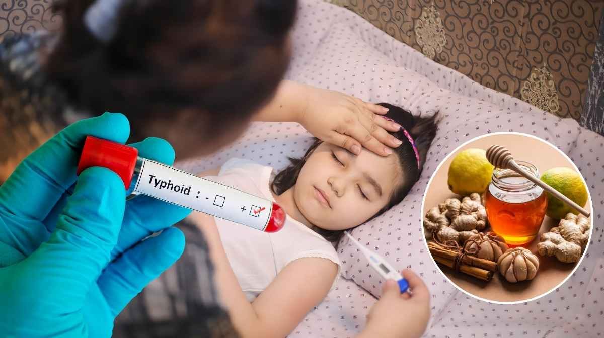 Typhoid fever