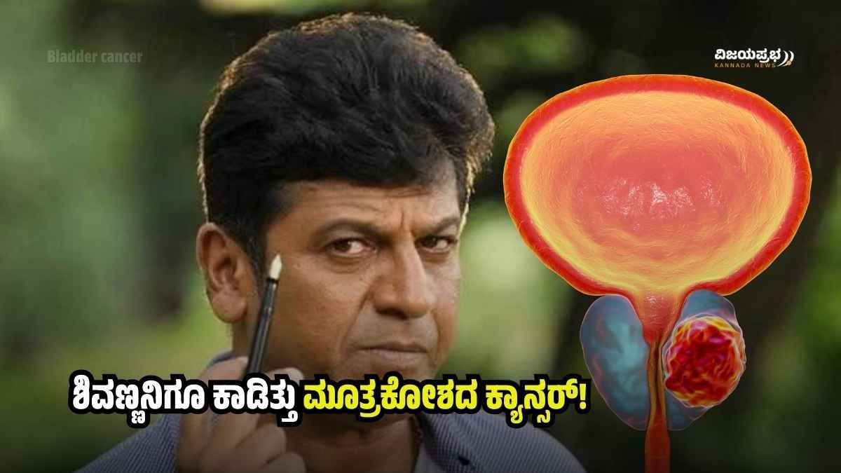 What are the symptoms of bladder cancer that afflicted actor Shivarajkumar