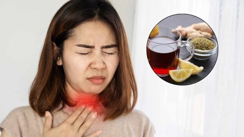 Home Remedies for Sore Throat