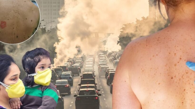 Pollution cause skin cancer