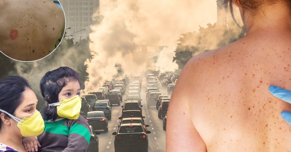 Pollution cause skin cancer